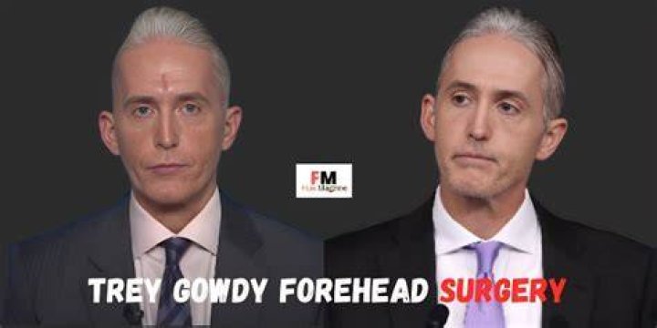 What is Wrong with Trey Gowdy's Nose: A Comprehensive Analysis